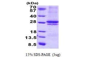Image no. 1 for Cytokine Receptor-Like Factor 2 (CRLF2) protein (His tag) (ABIN1098797) (CRLF2 Protein (His tag))