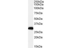 Western Blotting (WB) image for anti-Arginine Decarboxylase (ADC) (C-Term) antibody (ABIN2156351) (ADC Antikörper  (C-Term))