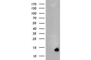 Image no. 1 for anti-Chromosome 17 Open Reading Frame 37 (C17orf37) antibody (ABIN1501776) (C17orf37 Antikörper)