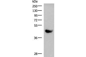 Western Blotting (WB) image for anti-Killer Cell Immunoglobulin-Like Receptor, Two Domains, Long Cytoplasmic Tail, 5A (KIR2DL5A) antibody (ABIN7245485)