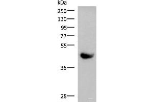 Western blot analysis of Human plasma solution using KIR2DL5A Polyclonal Antibody at dilution of 1:1000 (KIR2DL5A Antikörper)