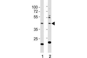 Western blot testing of E2F1 antibody at 1:1000 dilution.