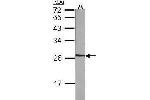 WB Image Sample (30 ug of whole cell lysate) A:NIH-3T3 12% SDS PAGE antibody diluted at 1:1000 (NME5 Antikörper  (Center))