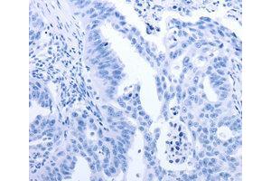 Immunohistochemistry (IHC) image for anti-Gem (Nuclear Organelle) Associated Protein 2 (GEMIN2) antibody (ABIN1872798) (SIP1 Antikörper)