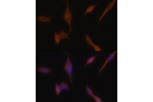 Immunofluorescence analysis of NIH-3T3 cells using MLPH antibody (ABIN6128273, ABIN6143892, ABIN6143893 and ABIN6222354) at dilution of 1:100. (Melanophilin Antikörper  (AA 301-600))