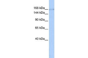 WB Suggested Anti-ZNF608 Antibody Titration:  0. (ZNF608 Antikörper  (Middle Region))