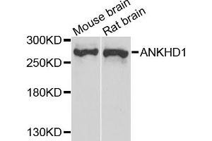 Western blot analysis of extract of mouse brain and rat brain cells, using ANKHD1 antibody.