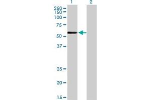 Western Blot analysis of ZNF165 expression in transfected 293T cell line by ZNF165 monoclonal antibody (M02), clone 2B8. (ZNF165 Antikörper  (AA 1-485))