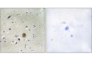 Immunohistochemistry analysis of paraffin-embedded human brain tissue, using MEK1 (Ab-298) Antibody. (MEK1 Antikörper  (AA 264-313))