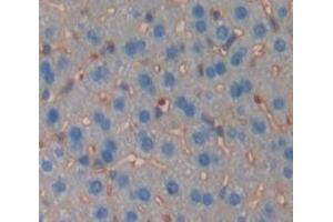 IHC-P analysis of Mouse Tissue, with DAB staining. (TGFBR2 Antikörper  (AA 209-590))