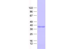 Validation with Western Blot (C11ORF49 Protein (His tag))