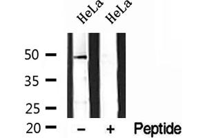 Western blot analysis of extracts of HeLa cells, using DEK antibody.