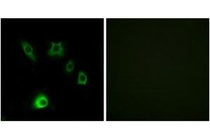 Immunofluorescence analysis of HuvEc cells, using FGF18 Antibody. (FGF18 Antikörper  (AA 151-200))