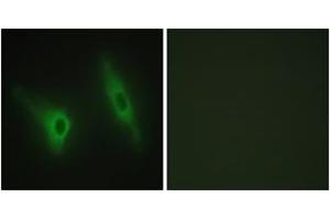 Immunofluorescence analysis of HeLa cells, using CKI-epsilon Antibody. (CK1 epsilon Antikörper  (AA 276-325))