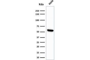 Western Blot Analysis of HeLa cell lysate using HSP60 Monoclonal Antibody (LK1) (HSPD1 Antikörper)