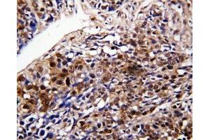 IHC-P: DDT antibody testing of human lung cancer tissue