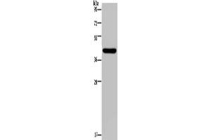 Gel: 10 % SDS-PAGE, Lysate: 40 μg, Lane: Human hepatocellular carcinoma tissue, Primary antibody: (NPHS2 Antibody) at dilution 1/200, Secondary antibody: Goat anti rabbit IgG at 1/8000 dilution, Exposure time: 2 minutes (Podocin Antikörper)