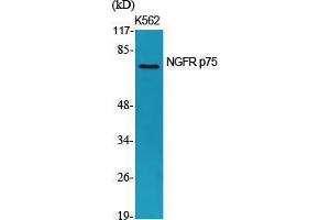 Western Blot (WB) analysis of specific cells using NGFR p75 Polyclonal Antibody. (NGFR Antikörper  (Internal Region))