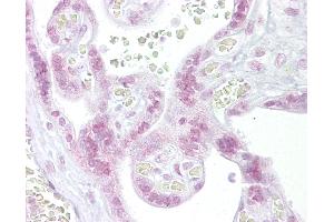 Anti-CHEK2 / CHK2 antibody IHC of human placenta. (CHEK2 Antikörper  (N-Term))