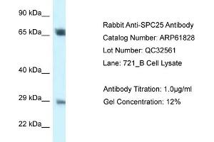 Western Blotting (WB) image for anti-SPC25, NDC80 Kinetochore Complex Component, Homolog (SPC25) (Middle Region) antibody (ABIN2788919) (SPC25 Antikörper  (Middle Region))