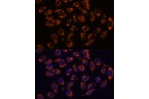 Immunofluorescence analysis of HeLa cells using CRELD1 antibody (ABIN7266621) at dilution of 1:100. (CRELD1 Antikörper  (AA 50-150))