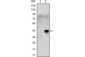 Western Blotting (WB) image for anti-Oligodendrocyte Lineage Transcription Factor 2 (OLIG2) antibody (ABIN1845900)