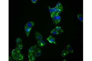 Immunofluorescence staining of Hela cells with ABIN7127774 at 1:36, counter-stained with DAPI. (Rekombinanter PRKAR1A Antikörper)