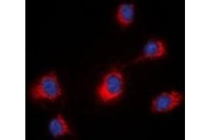 Immunofluorescent analysis of MID1 staining in HeLa cells.