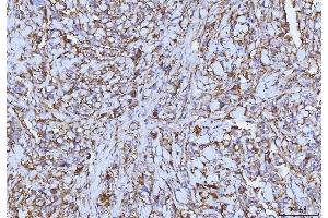IHC analysis of CD147/Emmprin using anti-CD147/Emmprin antibody (ABIN7599997). (CD147 Antikörper  (AA 138-323))