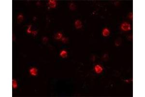 Immunofluorescencent staining of Daudi cells with CD244 polyclonal antibody  at 20 ug/mL. (2B4 Antikörper  (C-Term))