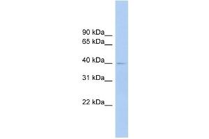 FCRLA antibody used at 1 ug/ml to detect target protein. (FCRLA Antikörper  (Middle Region))
