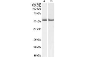 ABIN185366 (1µg/ml) staining of Human Breast (A) and Breast cancer (B) lysate (35µg protein in RIPA buffer). (Retinoic Acid Receptor alpha Antikörper  (C-Term))
