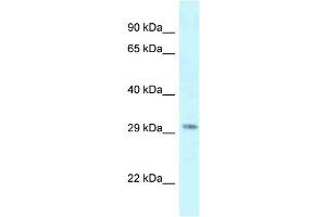 Antibody Titration: 1. (SUV420H1 Antikörper  (C-Term))