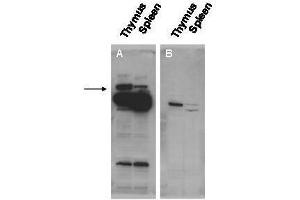 Western blot using  affinity purified anti-Pogz antibody shows detection of Pogz protein (arrowhead) in adult mouse thymus and spleen tissue lysate (Panel A). (POGZ Antikörper  (N-Term))