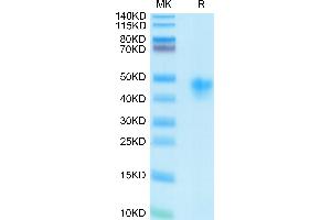 Human IL-2 R alpha/CD25 on Tris-Bis PAGE under reduced condition. (CD25 Protein (AA 22-213) (His-Avi Tag))