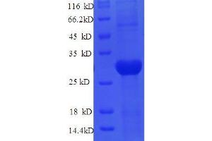 Lysyl Oxidase (LOX) (AA 163-411) protein (His tag) expressed in E.