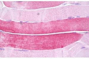 Anti-HSPB6 antibody IHC staining of human skeletal muscle.