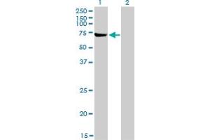 Western Blot analysis of ABCF2 expression in transfected 293T cell line by ABCF2 monoclonal antibody (M01), clone 1D11. (ABCF2 Antikörper  (AA 1-110))