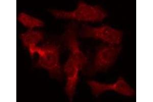 ABIN6275469 staining Hela by IF/ICC. (RAB40B Antikörper  (C-Term))