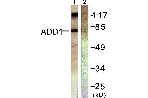 Western blot analysis of extracts from Hela cells treated with Forskolin (40nM, 30min), using ADD1 (Ab-726) antibody (#B0002, Line 1 and 2). (alpha Adducin Antikörper  (Ser726))