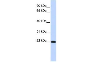WB Suggested Anti-FXYD5 Antibody Titration:  0. (FXYD5 Antikörper  (Middle Region))