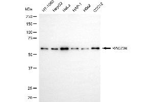 anti-RAD23 Homolog B (RAD23B) antibody