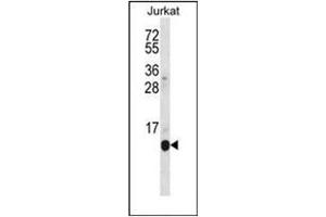 Western blot analysis of POLR2G Antibody (C-term) in Jurkat cell line lysates (35ug/lane). (POLR2G Antikörper  (C-Term))