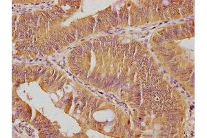 Immunohistochemistry (IHC) image for anti-SKI Family Transcriptional Corepressor 2 (SKOR2) (AA 19-36) antibody (ABIN7140147)