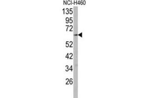 Western Blotting (WB) image for anti-Cytochrome P450, Family 2, Subfamily R, Polypeptide 1 (CYP2R1) antibody (ABIN3003558) (CYP2R1 Antikörper)