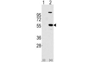 Western blot analysis of ALDH1A1 antibody and 293 cell lysate (2 ug/lane) either nontransfected (Lane 1) or transiently transfected with the ALDH1A1 gene (2). (ALDH1A1 Antikörper  (AA 302-331))