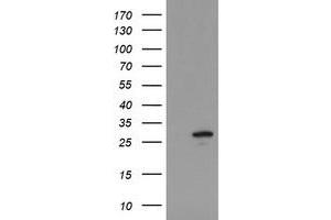 Image no. 1 for anti-Ubiquitin-Conjugating Enzyme E2S (UBE2S) antibody (ABIN1501646) (UBE2S Antikörper)