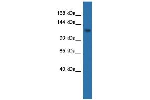 WB Suggested Anti-CDKL5  Antibody Titration: 0. (CDKL5 Antikörper  (C-Term))