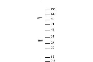 LIN28A antibody (pAb) tested by Western blot. (LIN28A Antikörper  (C-Term))