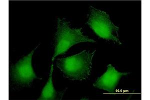 Immunofluorescence of monoclonal antibody to RIOK2 on HeLa cell. (RIOK2 Antikörper  (AA 453-551))